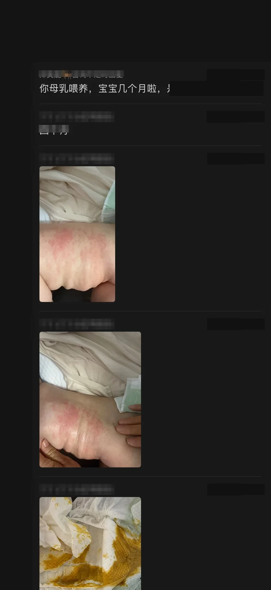 母乳期湿疹案例沟通与阶段照片，身份信息及面部已处理