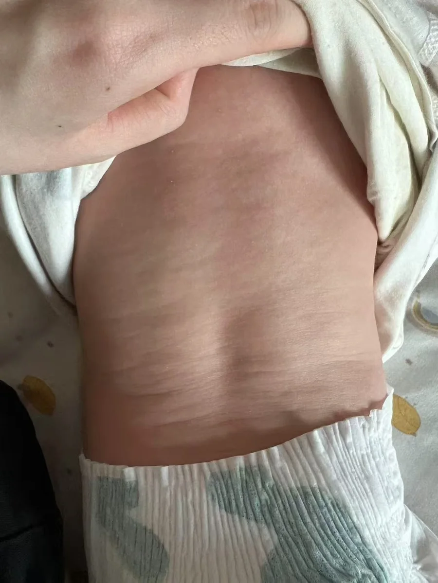 菌群检测案例后续身体状态阶段照片